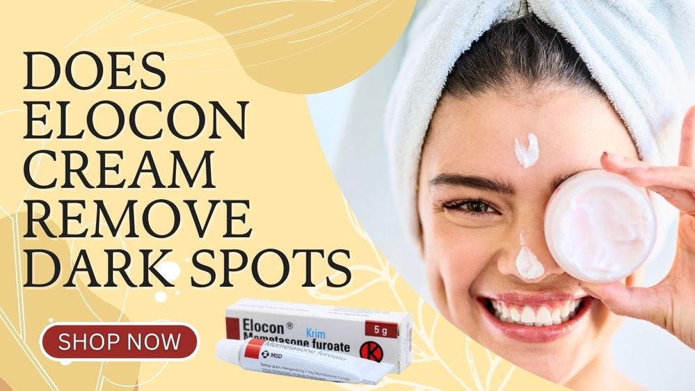 Does elocon cream remove dark spots.jpg